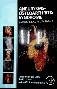 Image of ANEURYSMS-OSTEOARTHRITIS SYNDROME: SMAD3 GENE MUTATIONS